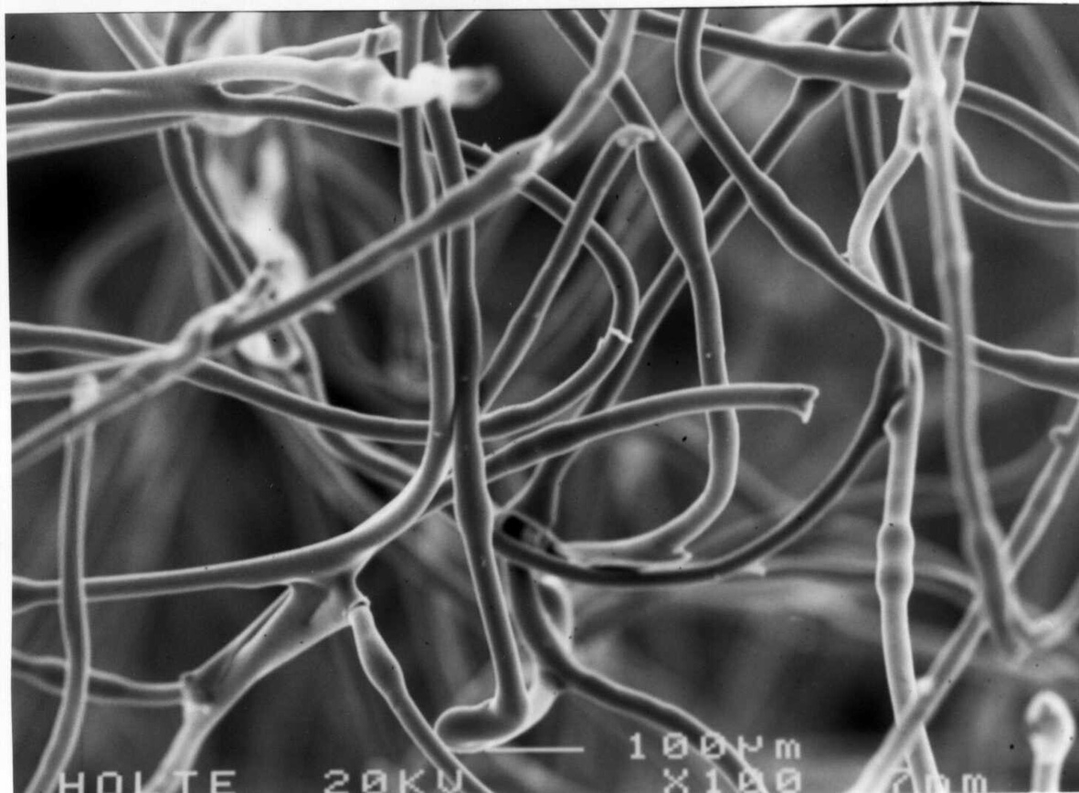 Transfer of Fibres – Major New Research Published